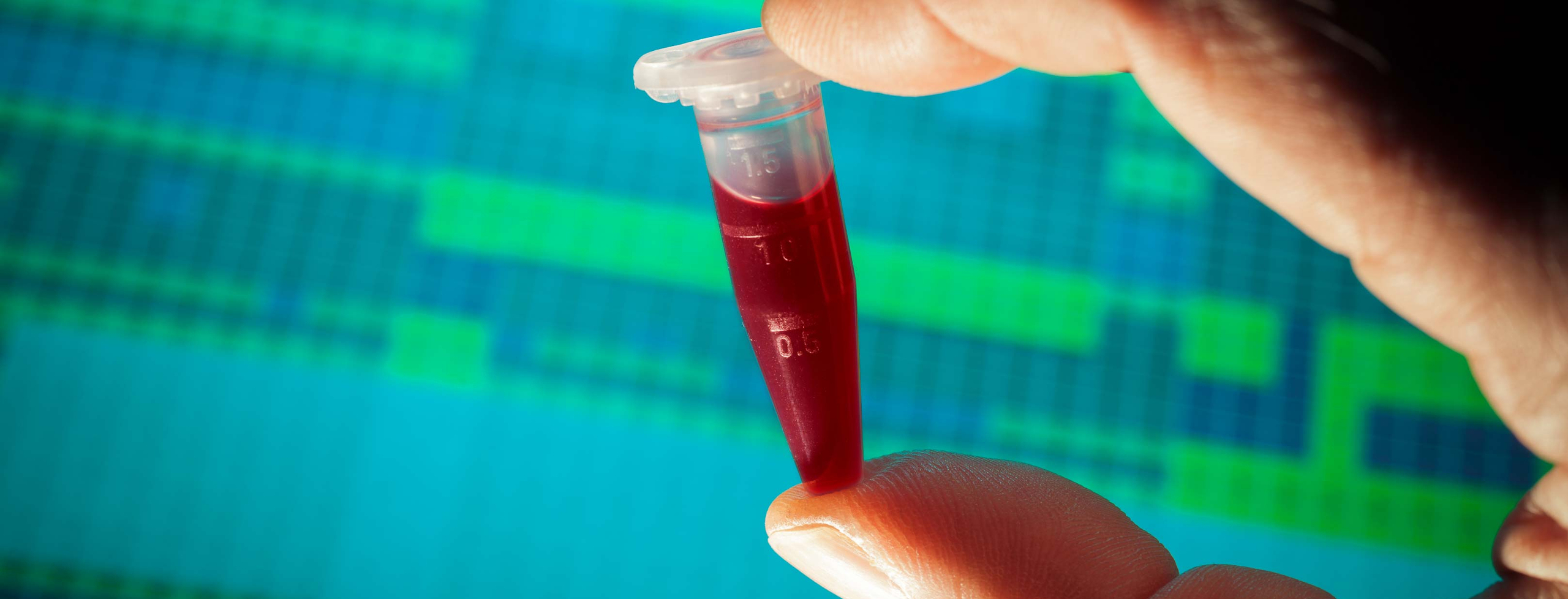 Micro test tube with blood